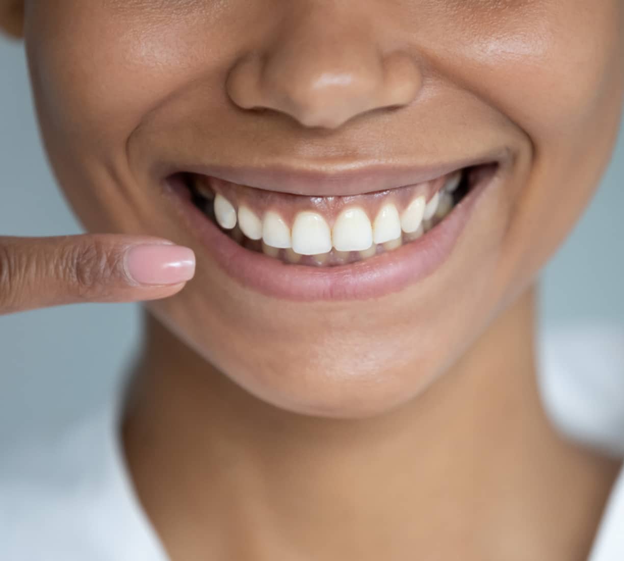 Woman pointing to her perfect smile