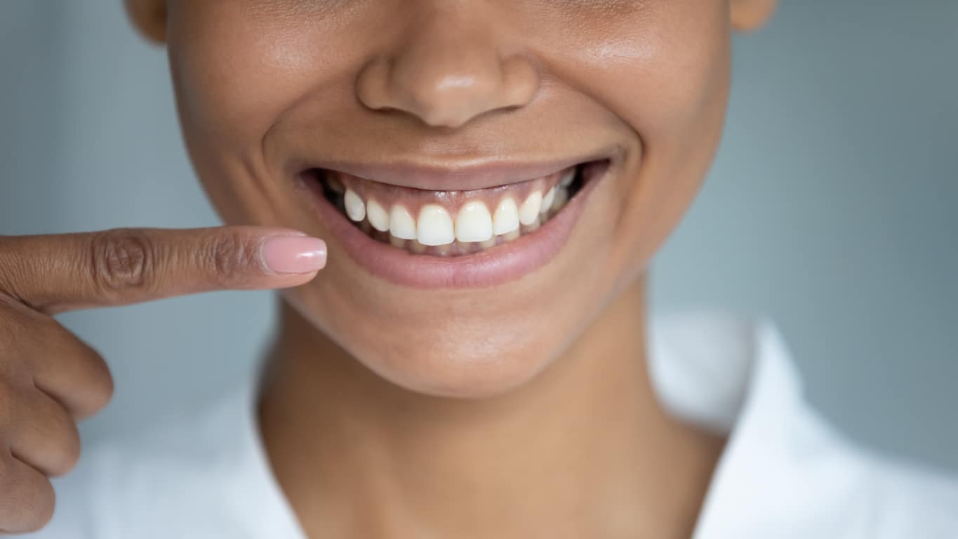 Woman pointing to her white teeth
