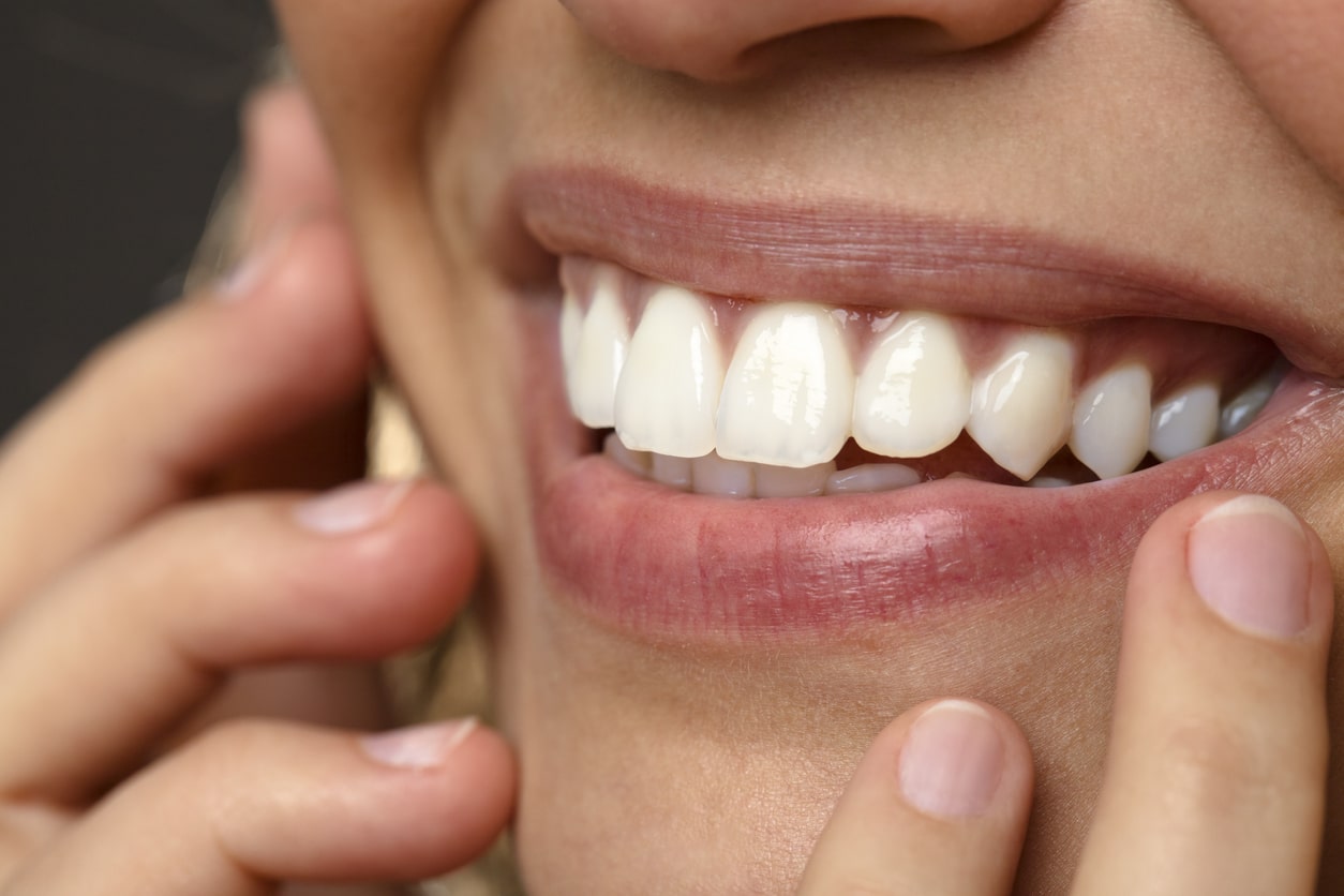 Woman showing off her perfect smile