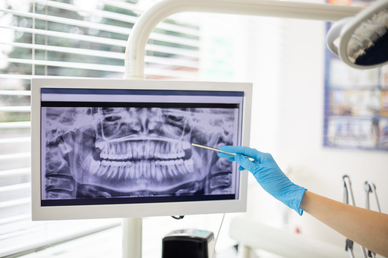 Dentist observing a dental x-ray