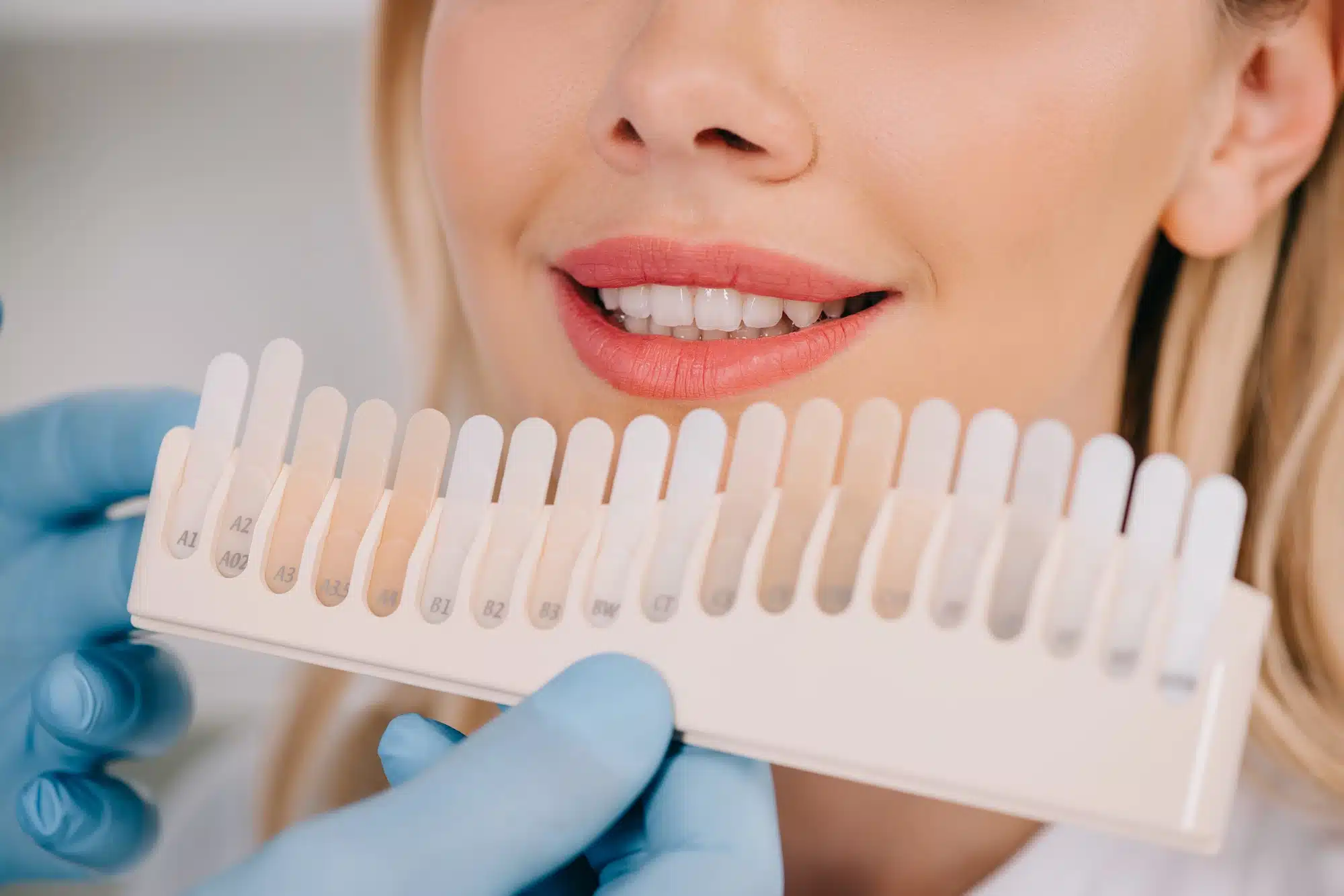 Cosmetic dentist novi mi helping patient choose whitening shade