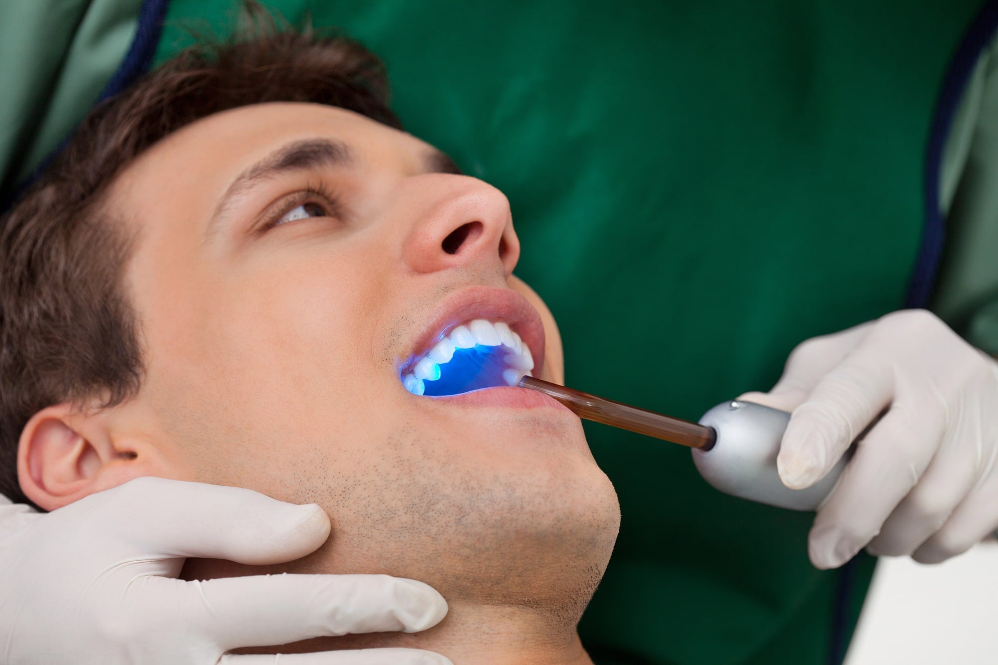 man getting bonding with cosmetic dentist in detroit mi