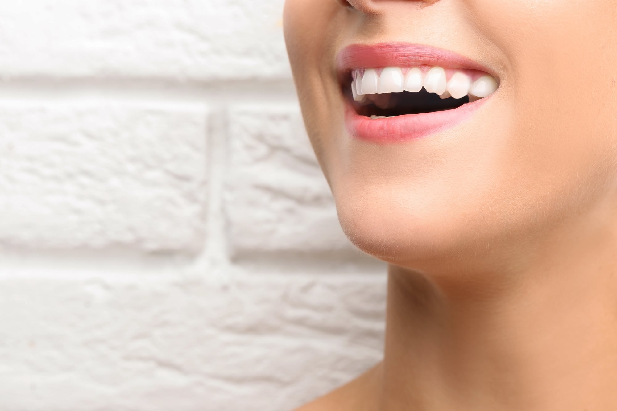 woman smiling after bonding from cosmetic dentist in detroit mi