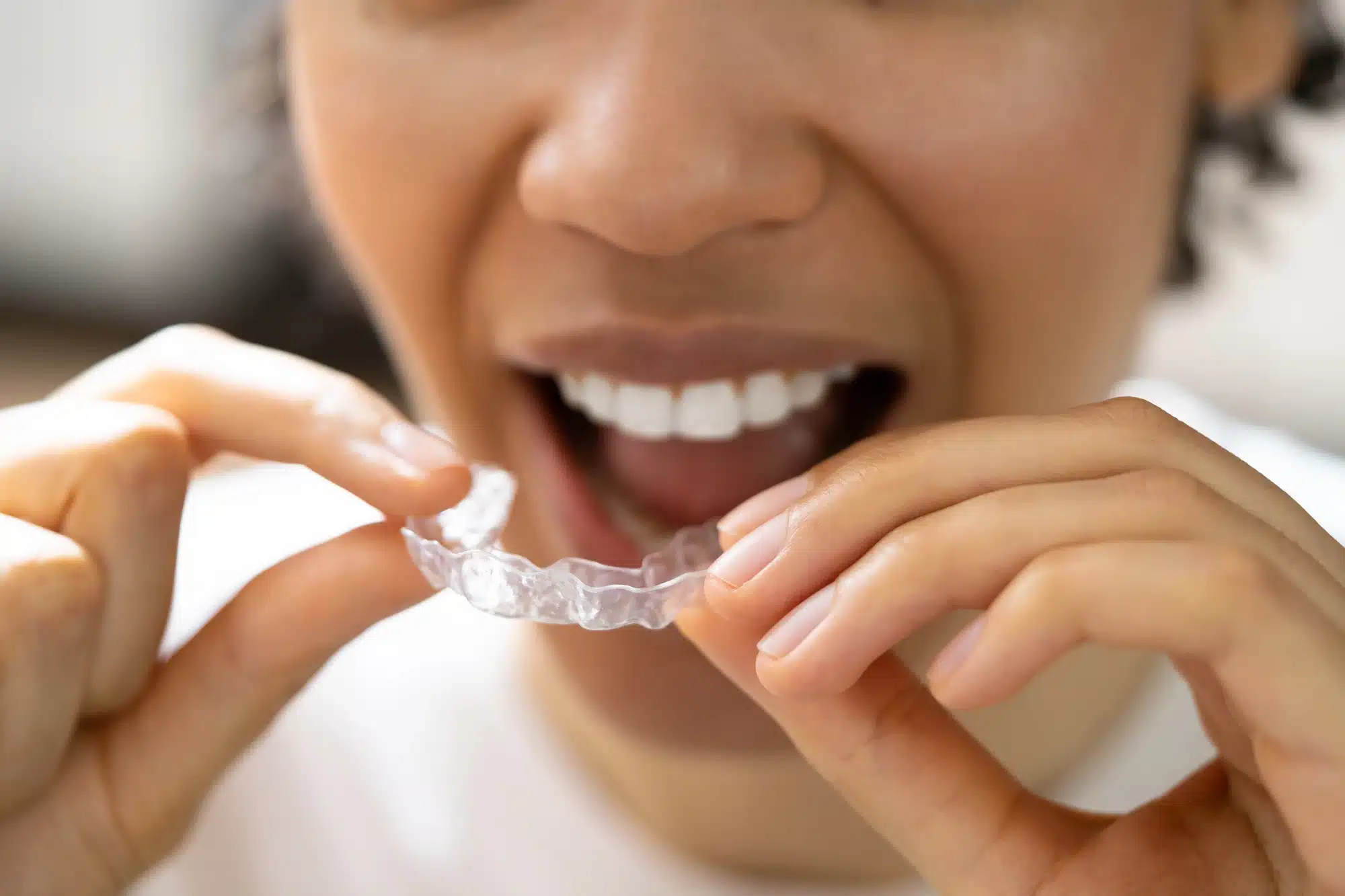 woman wearing invisalign detroit