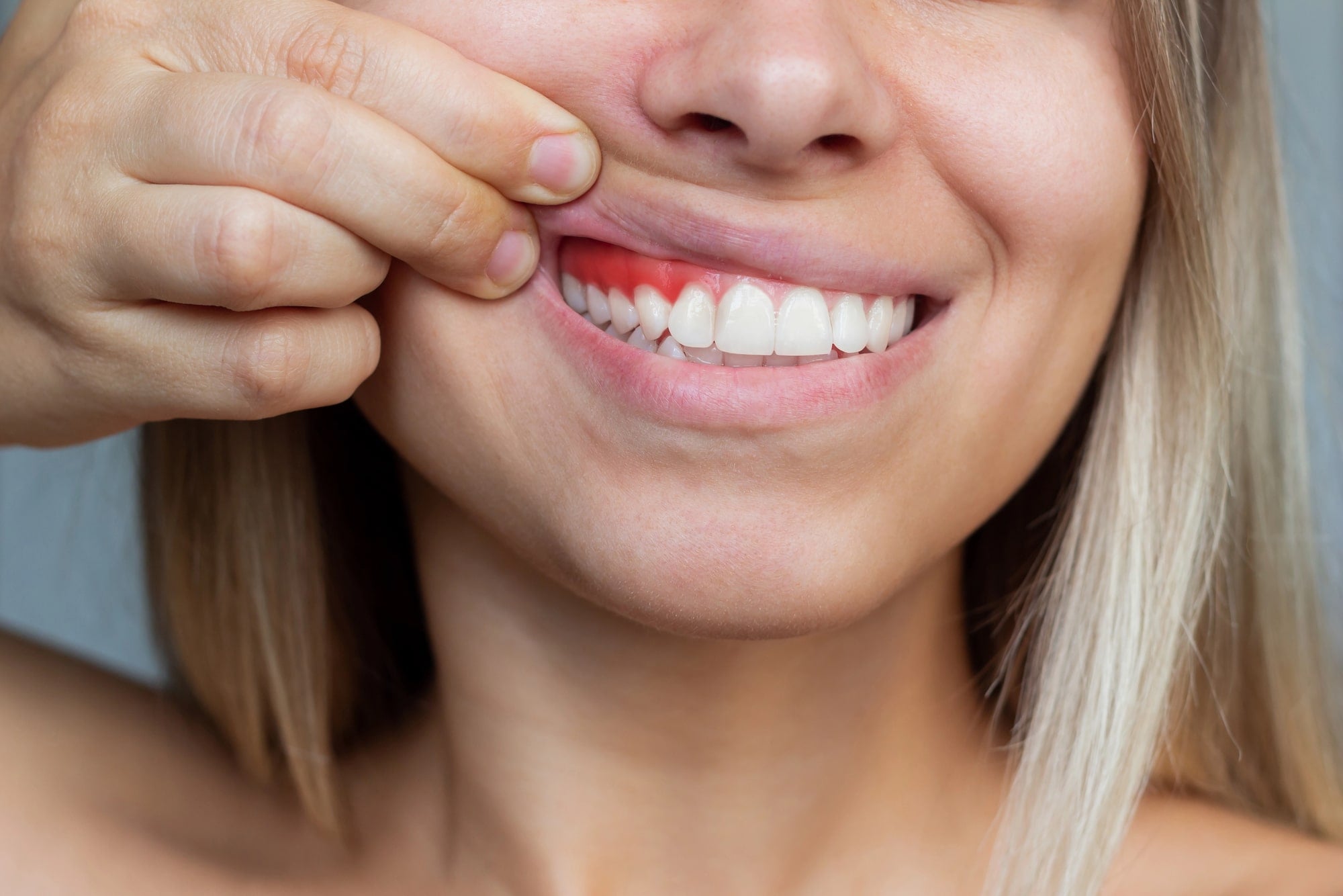 woman with bleeding gums needs dentist detroit