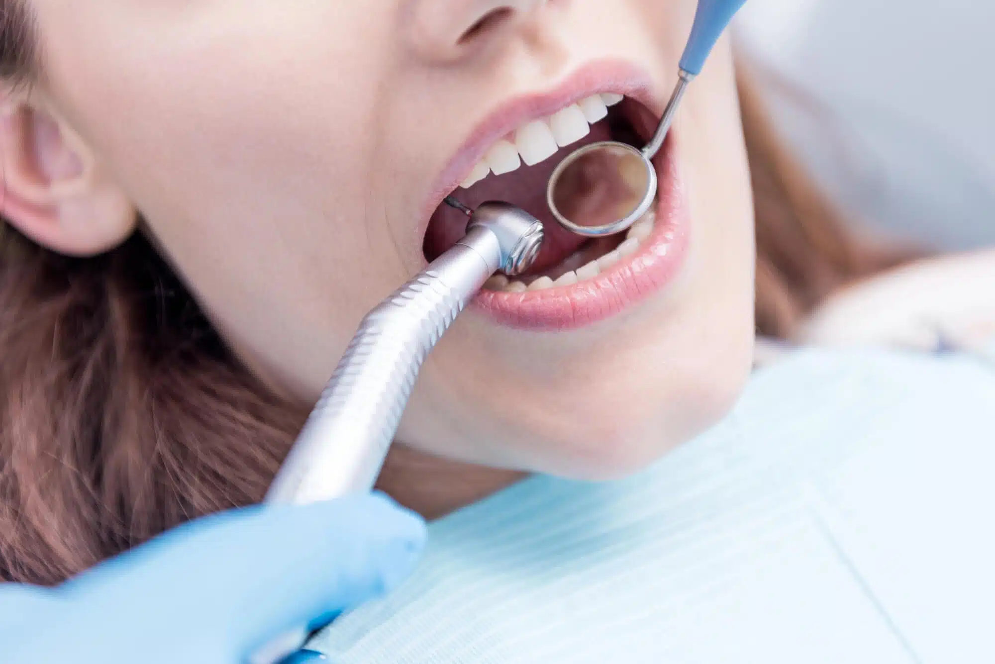 Woman undergoing dental bonding detroit